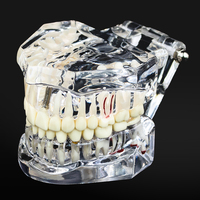 1 szt. Model dentystyczny Zęby Implant Przywrócenie mostu Badanie dydaktyczne Ząb Nauki medyczne Choroby dentysty Produkty stomatologiczne 6